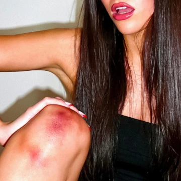 bruises (2026)